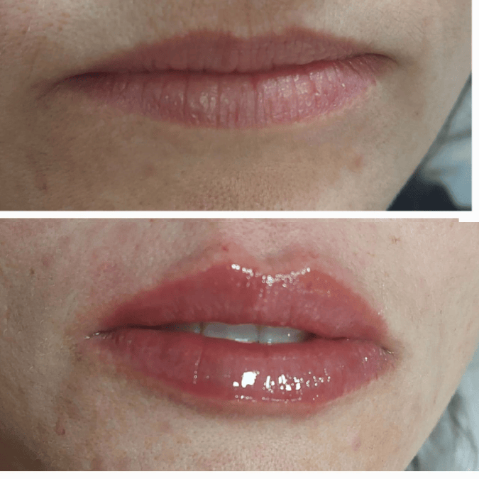 Logotipo Monograma Elegante Preto (13)