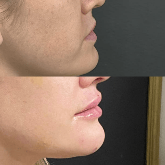 Logotipo Monograma Elegante Preto (14)