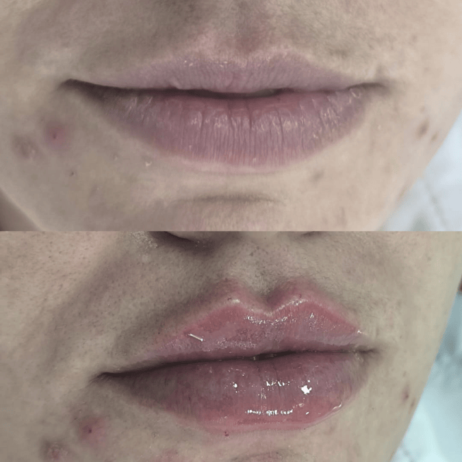 Logotipo Monograma Elegante Preto (7)