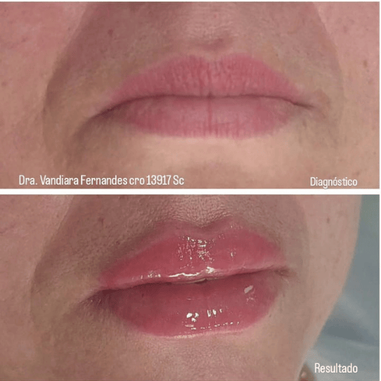 Logotipo Monograma Elegante Preto